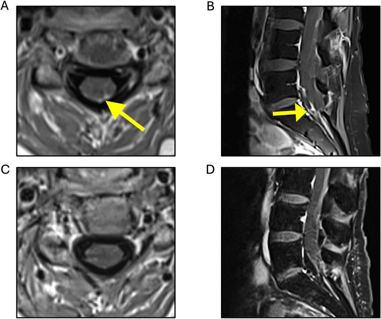 https://cdn.ncbi.nlm.nih.gov/pmc/blobs/971d/12380859/5ca290ee9d03/fonc-15-1559085-g002.jpg