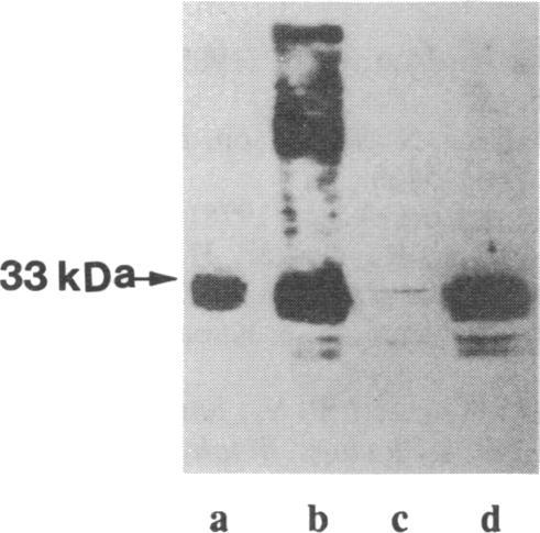 https://cdn.ncbi.nlm.nih.gov/pmc/blobs/9722/48829/800b1985f435/pnas01082-0029-c.jpg