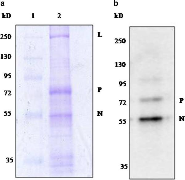 https://cdn.ncbi.nlm.nih.gov/pmc/blobs/9726/3544616/2e068fa1d6f8/1743-422X-9-302-1.jpg