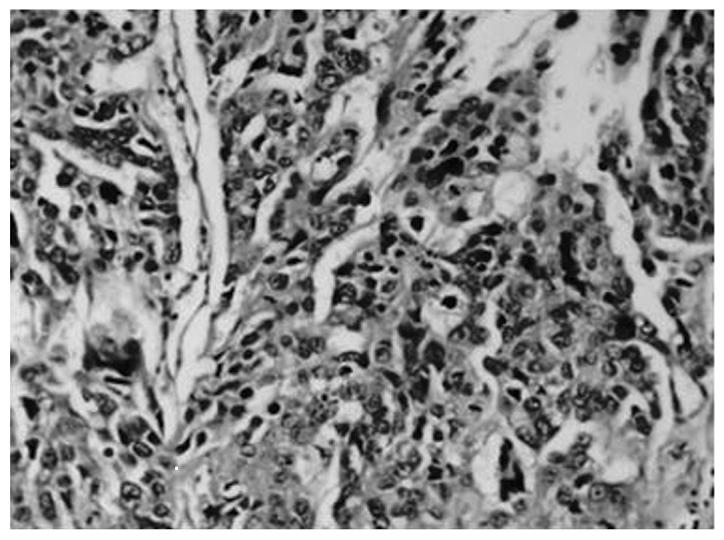 https://cdn.ncbi.nlm.nih.gov/pmc/blobs/9726/4301519/5d5ebdf20e06/OL-09-02-0915-g01.jpg