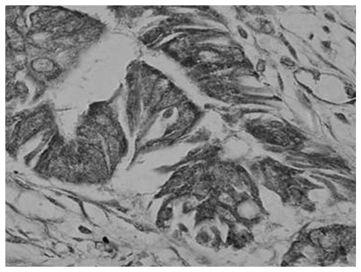 https://cdn.ncbi.nlm.nih.gov/pmc/blobs/9726/4301519/93276c9088cf/OL-09-02-0915-g02.jpg