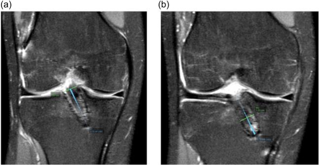 https://cdn.ncbi.nlm.nih.gov/pmc/blobs/972e/11551069/be4d1a40cf3a/JEO2-11-e70068-g004.jpg
