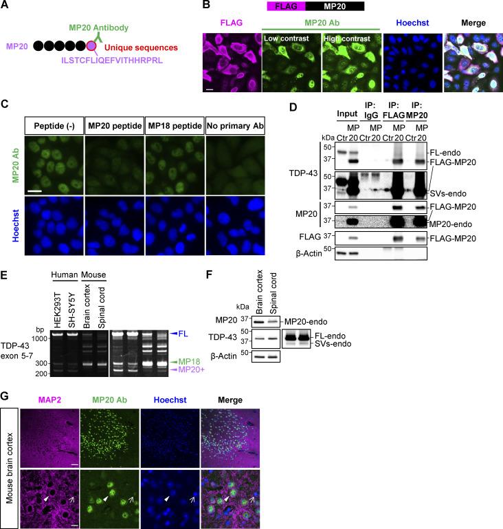 https://cdn.ncbi.nlm.nih.gov/pmc/blobs/9732/12333503/9824532b336d/jcb_202406097_fig4.jpg