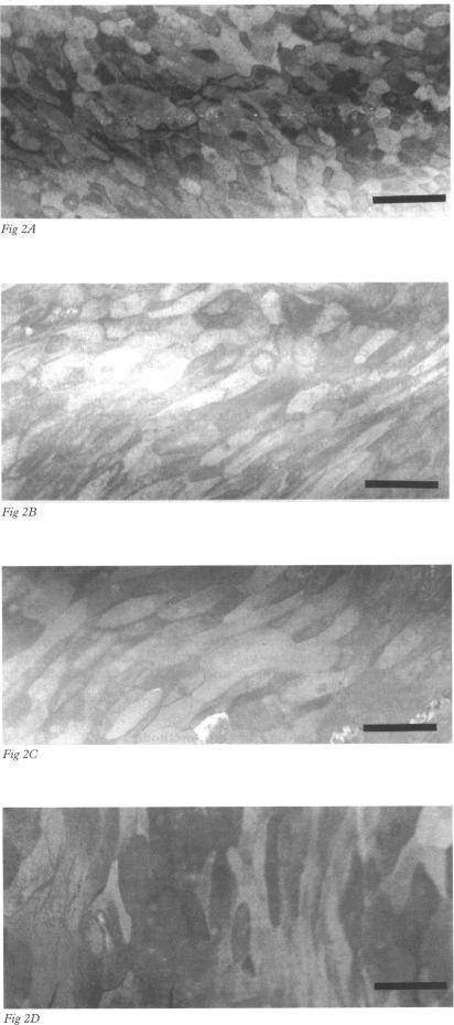 https://cdn.ncbi.nlm.nih.gov/pmc/blobs/9732/505074/ca7dec70f31a/brjopthal00015-0060-a.jpg