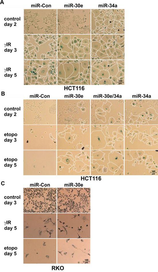 https://cdn.ncbi.nlm.nih.gov/pmc/blobs/9740/4941286/8d8818cbd842/oncotarget-07-15915-g002.jpg
