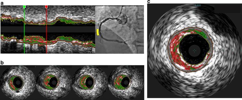 https://cdn.ncbi.nlm.nih.gov/pmc/blobs/9741/5549371/240f88c3683d/12933_2017_577_Fig2_HTML.jpg