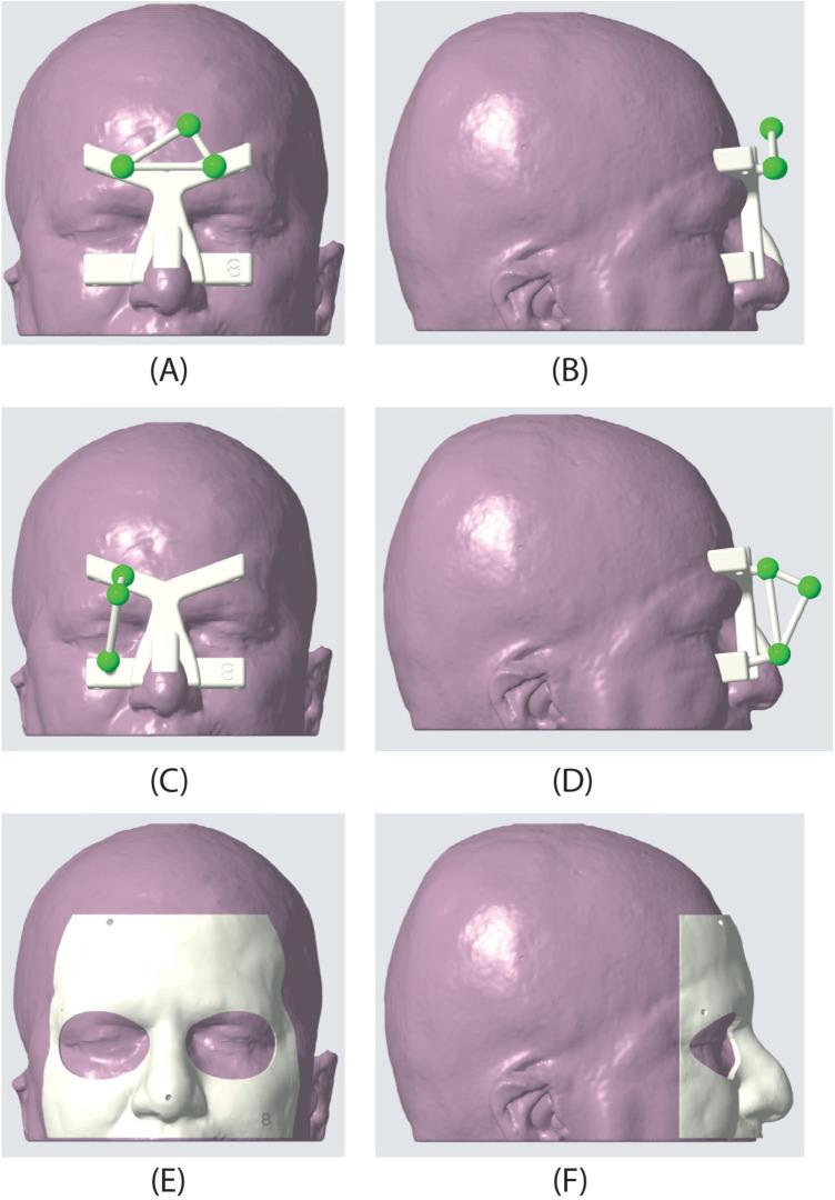 https://cdn.ncbi.nlm.nih.gov/pmc/blobs/9750/11772343/8180ee533794/fdgth-06-1500677-g002.jpg
