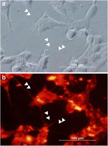https://cdn.ncbi.nlm.nih.gov/pmc/blobs/9753/5683209/082020e7cb97/12964_2017_201_Fig1_HTML.jpg