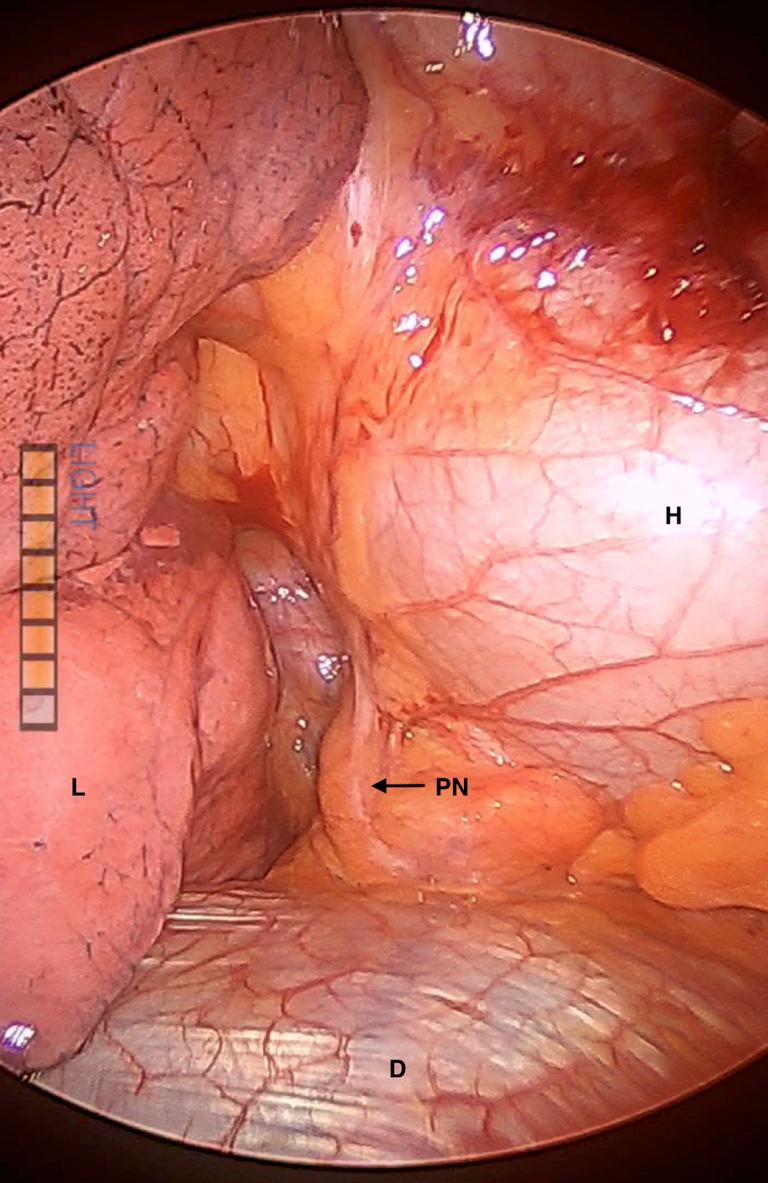 https://cdn.ncbi.nlm.nih.gov/pmc/blobs/9753/6951311/9fd80f0025ee/gr2.jpg