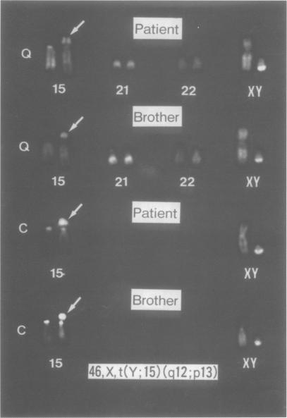 https://cdn.ncbi.nlm.nih.gov/pmc/blobs/9756/1051464/b902262a1103/jmedgene00239-0062-a.jpg