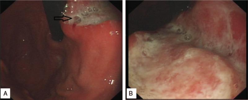 https://cdn.ncbi.nlm.nih.gov/pmc/blobs/9756/5779740/aad628f447a4/medi-97-e9484-g003.jpg