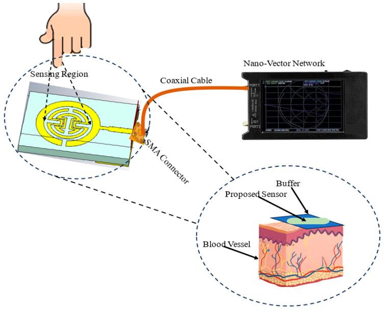 https://cdn.ncbi.nlm.nih.gov/pmc/blobs/9757/12024836/e53929459a3d/biosensors-15-00250-g001.jpg