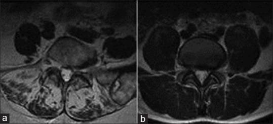 https://cdn.ncbi.nlm.nih.gov/pmc/blobs/9759/4431049/1deffeb634e7/SNI-6-240-g004.jpg