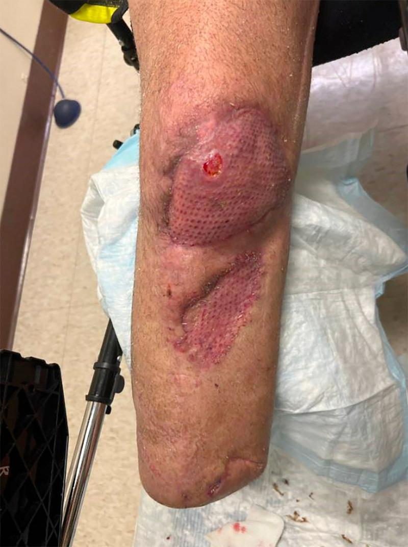 https://cdn.ncbi.nlm.nih.gov/pmc/blobs/975b/9668556/697482b08968/gox-10-e4568-g003.jpg