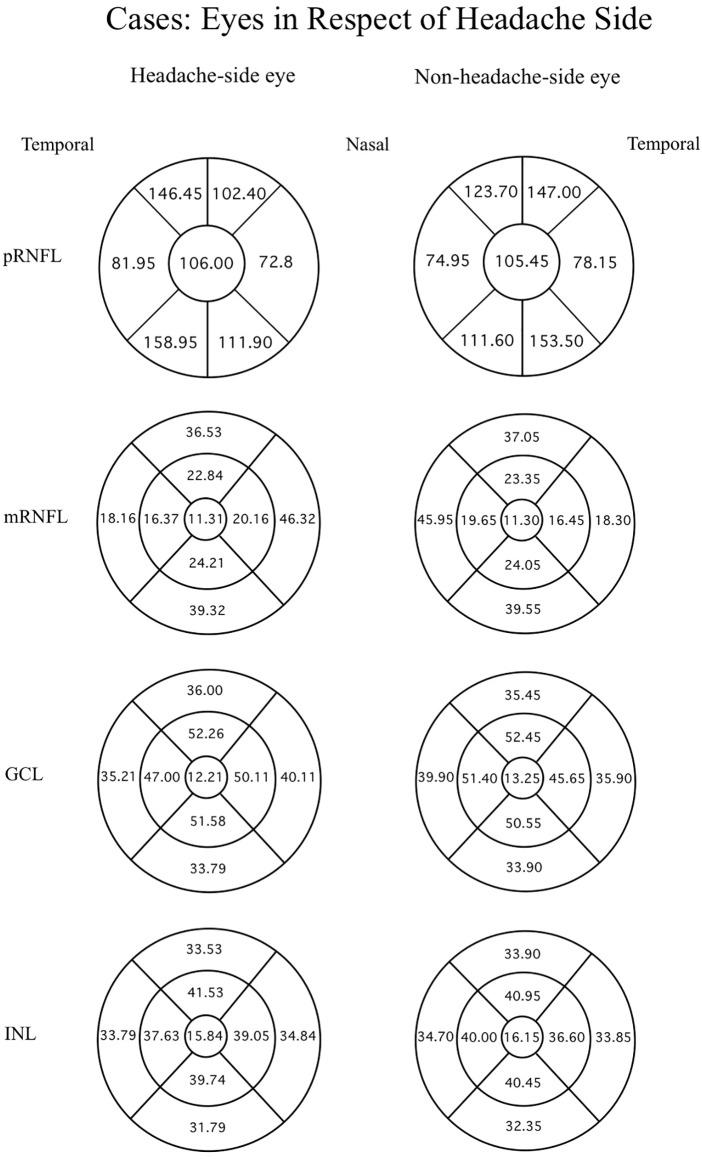 https://cdn.ncbi.nlm.nih.gov/pmc/blobs/9764/11138520/c1f75565a099/peerj-12-17454-g003.jpg