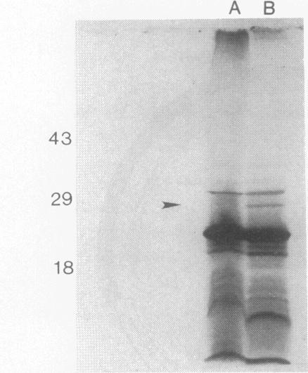 https://cdn.ncbi.nlm.nih.gov/pmc/blobs/976a/196103/f7042e9023b0/jbacter00043-0138-a.jpg