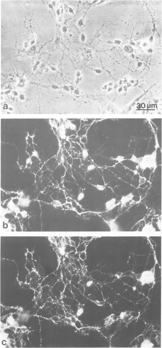 https://cdn.ncbi.nlm.nih.gov/pmc/blobs/976a/557289/6372187840bc/emboj00305-0009-b.jpg