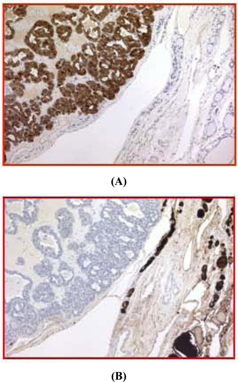 https://cdn.ncbi.nlm.nih.gov/pmc/blobs/976d/7360904/459859ce86d6/EMIDDT-19-226_F1.jpg