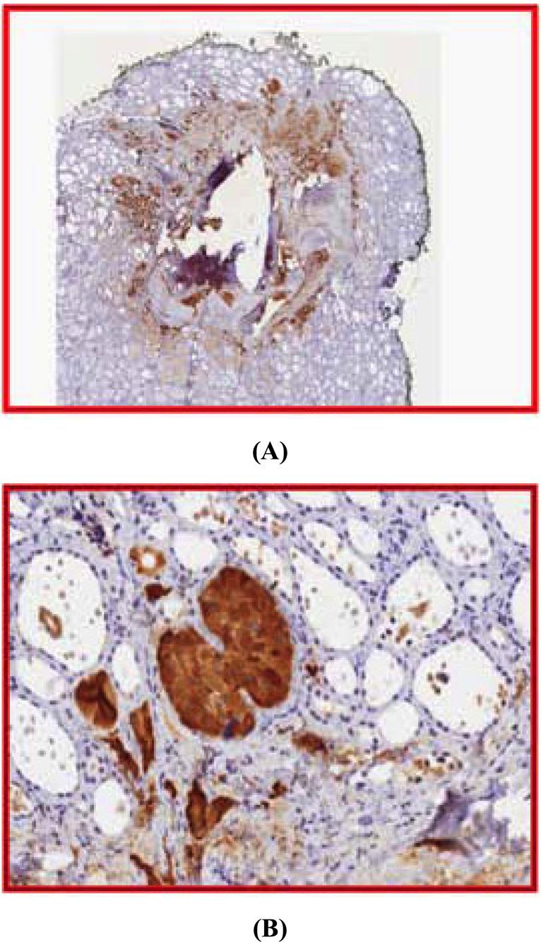 https://cdn.ncbi.nlm.nih.gov/pmc/blobs/976d/7360904/f10ff1b72cf3/EMIDDT-19-226_F2.jpg