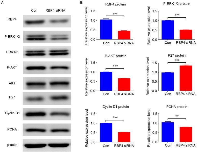 https://cdn.ncbi.nlm.nih.gov/pmc/blobs/9772/5865769/013c7ec39df2/mmr-16-05-5915-g05.jpg
