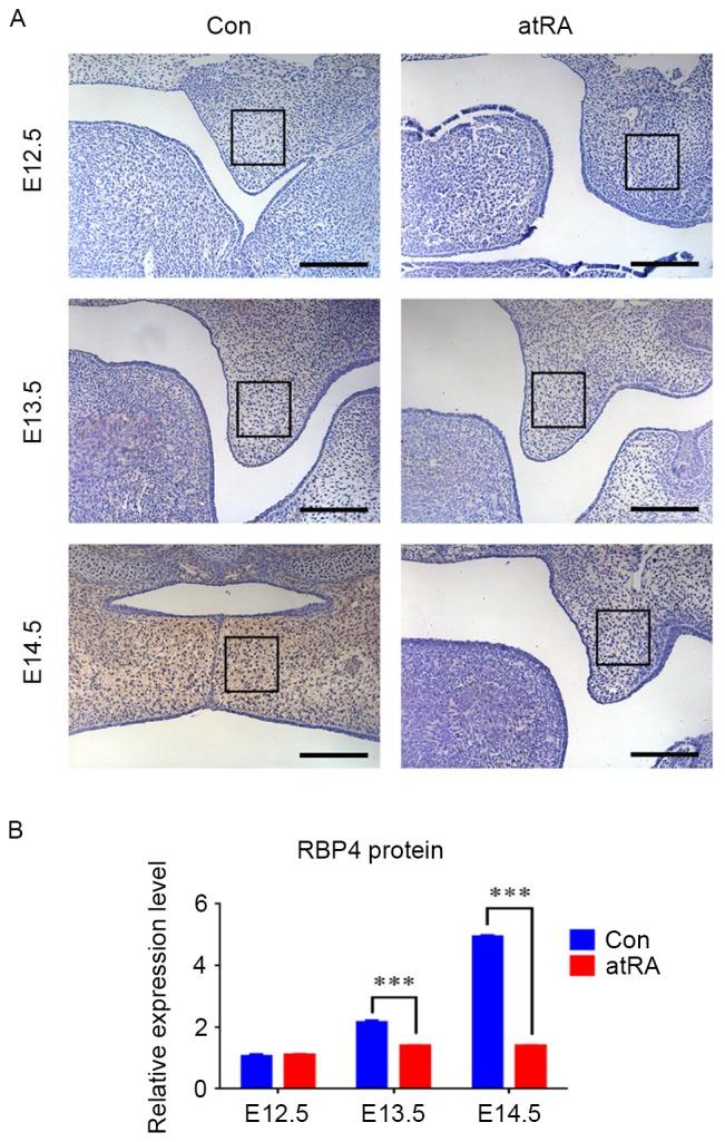 https://cdn.ncbi.nlm.nih.gov/pmc/blobs/9772/5865769/dae44bcf8248/mmr-16-05-5915-g00.jpg