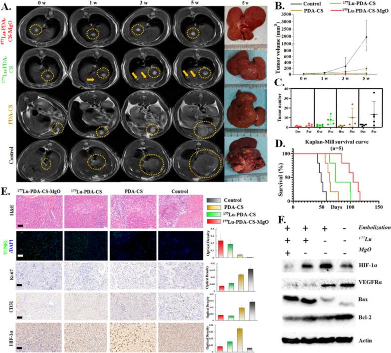 https://cdn.ncbi.nlm.nih.gov/pmc/blobs/9779/10625707/8ebc158c2a81/40824_2023_455_Fig5_HTML.jpg