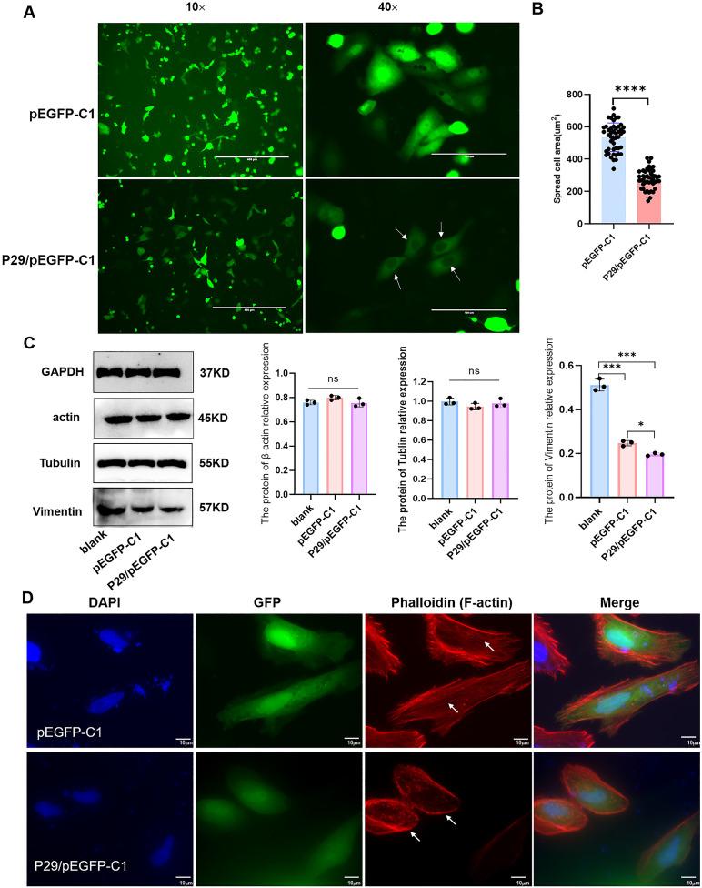 https://cdn.ncbi.nlm.nih.gov/pmc/blobs/977b/12081405/6add3907bb7c/fcimb-15-1560436-g002.jpg