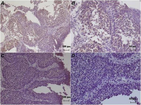 https://cdn.ncbi.nlm.nih.gov/pmc/blobs/977c/4061920/17dfb80df139/1756-9966-33-48-3.jpg