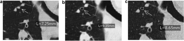 https://cdn.ncbi.nlm.nih.gov/pmc/blobs/9786/9356159/4ebe46826139/gr2.jpg