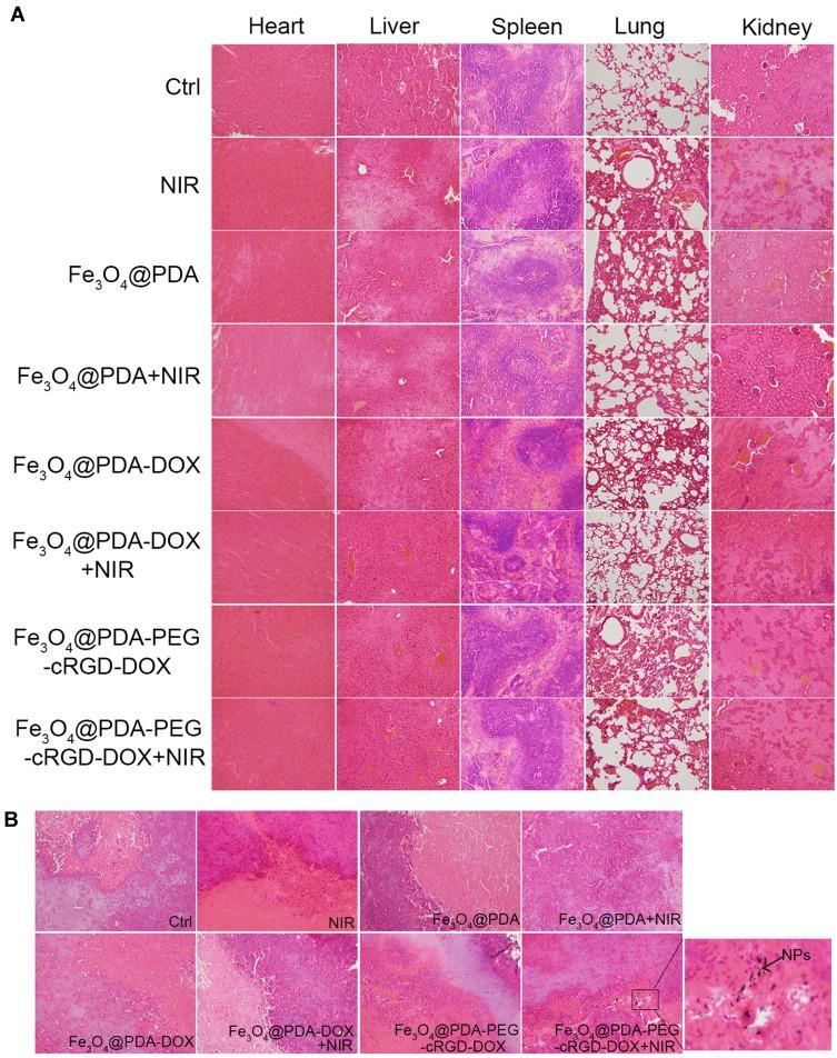 https://cdn.ncbi.nlm.nih.gov/pmc/blobs/9787/6901060/f83eb916e594/IJN-14-9631-g0010.jpg