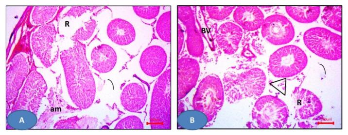 https://cdn.ncbi.nlm.nih.gov/pmc/blobs/9788/7672604/ec309be934b8/molecules-25-05057-g013.jpg