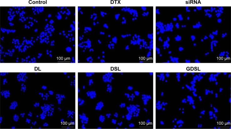https://cdn.ncbi.nlm.nih.gov/pmc/blobs/978a/5592908/6231509451a6/ijn-12-6461Fig7.jpg