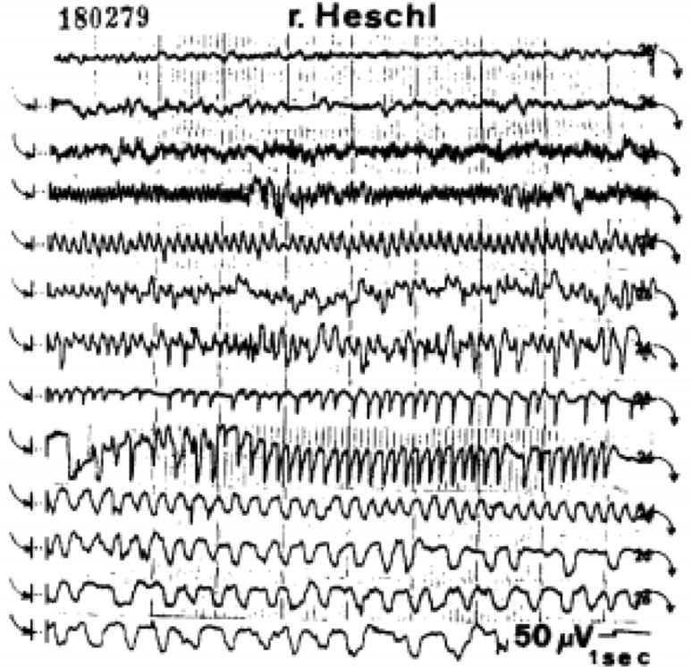 https://cdn.ncbi.nlm.nih.gov/pmc/blobs/978c/6517562/c210866cbe51/415_2019_9289_Fig3_HTML.jpg