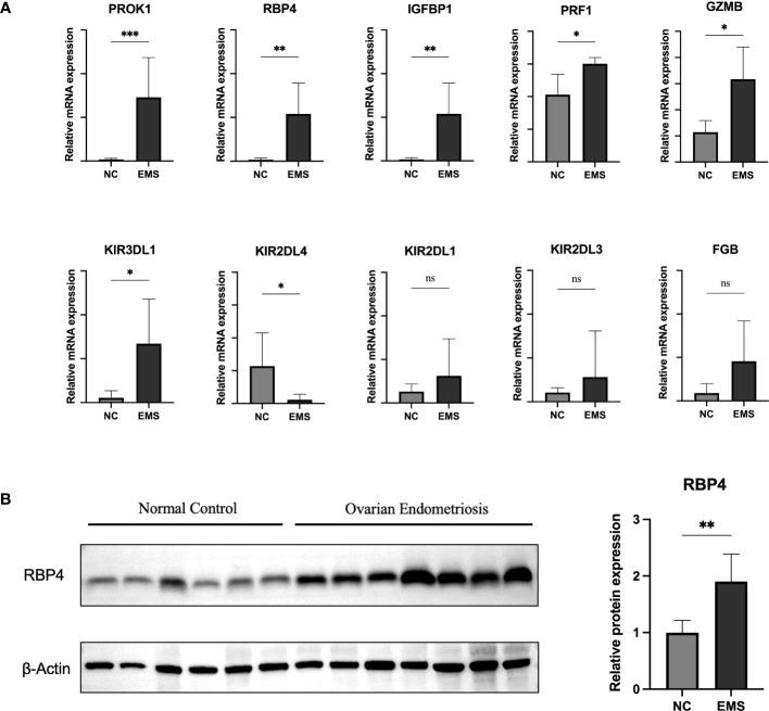 https://cdn.ncbi.nlm.nih.gov/pmc/blobs/9791/10471803/723b7528e167/fimmu-14-1130738-g008.jpg