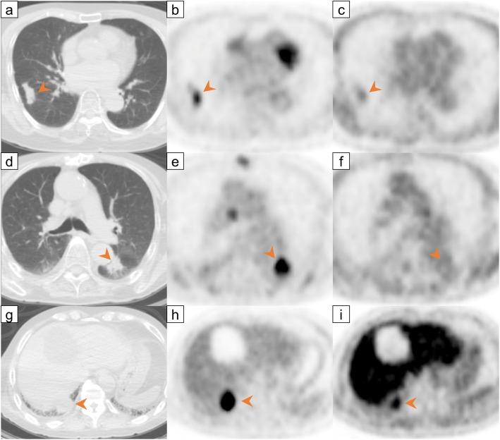 https://cdn.ncbi.nlm.nih.gov/pmc/blobs/9791/6892988/359ea7cc772e/13550_2019_578_Fig3_HTML.jpg