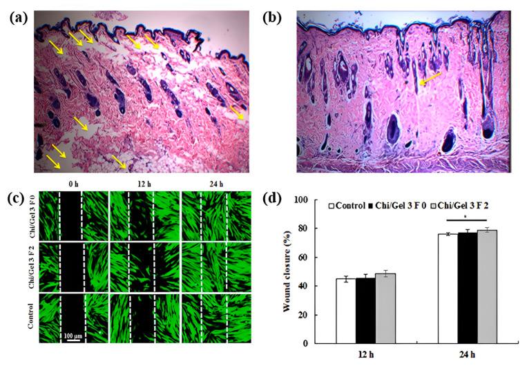 https://cdn.ncbi.nlm.nih.gov/pmc/blobs/9793/10007050/ab5dfe863d43/polymers-15-01253-g010.jpg