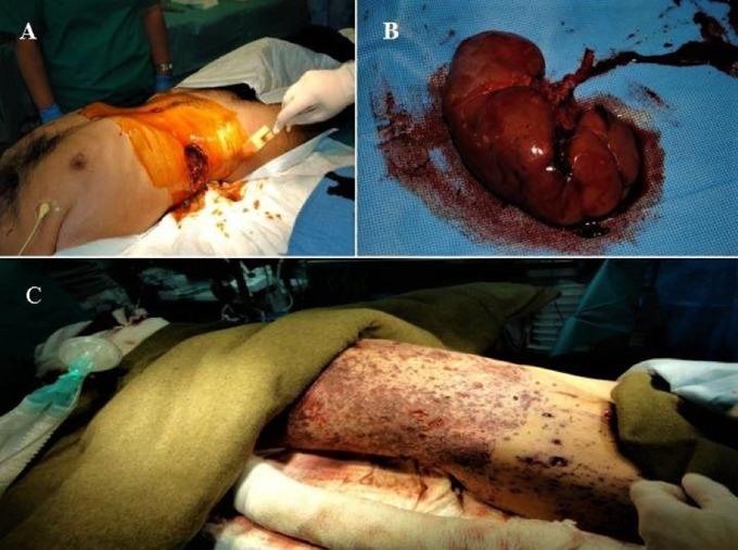 https://cdn.ncbi.nlm.nih.gov/pmc/blobs/9794/10770980/7a67f112434c/13031_2023_566_Fig3_HTML.jpg