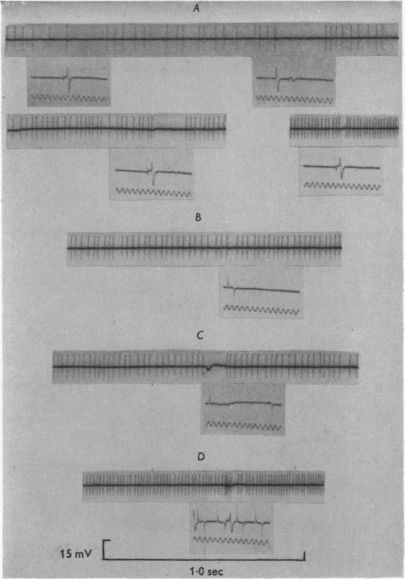 https://cdn.ncbi.nlm.nih.gov/pmc/blobs/979e/1358914/10305542f682/jphysiol01365-0108-a.jpg