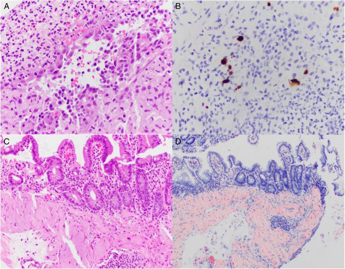 https://cdn.ncbi.nlm.nih.gov/pmc/blobs/979f/9584183/8c50ef32912e/ac9-9-e00876-g002.jpg