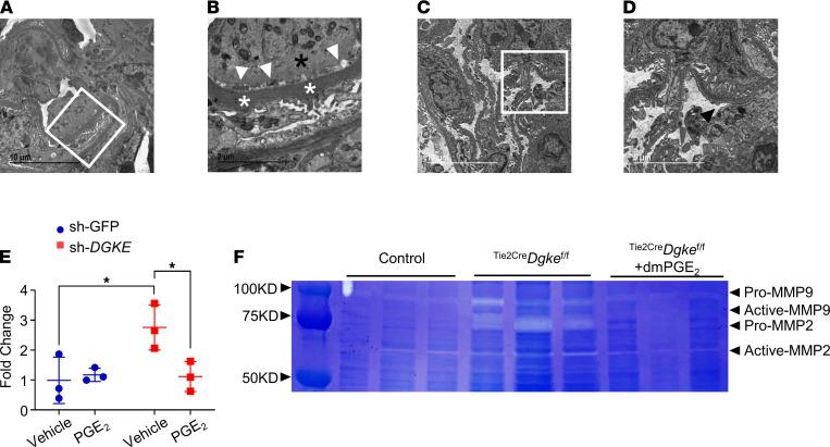 https://cdn.ncbi.nlm.nih.gov/pmc/blobs/97a0/8262293/94c8ad1d3b1d/jciinsight-6-146959-g017.jpg