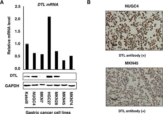 https://cdn.ncbi.nlm.nih.gov/pmc/blobs/97a1/4742199/f81b6cb83312/oncotarget-06-36615-g001.jpg