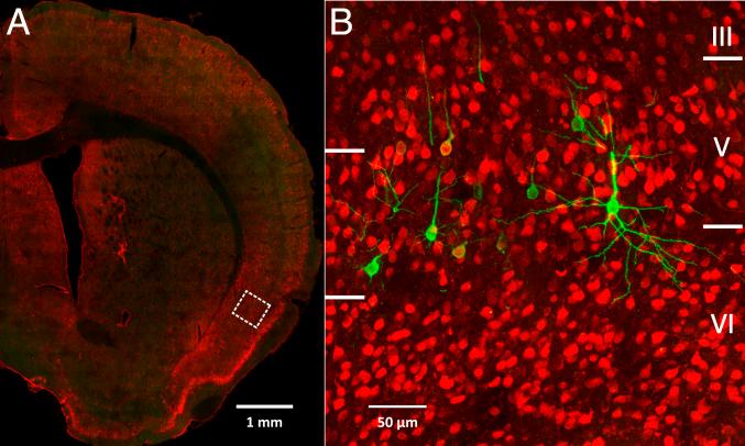 https://cdn.ncbi.nlm.nih.gov/pmc/blobs/97a5/7293610/4a210d9c9687/pnas.2002737117fig03.jpg