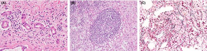 https://cdn.ncbi.nlm.nih.gov/pmc/blobs/97a5/8077398/11c9e49f3f60/CCR3-9-2254-g005.jpg