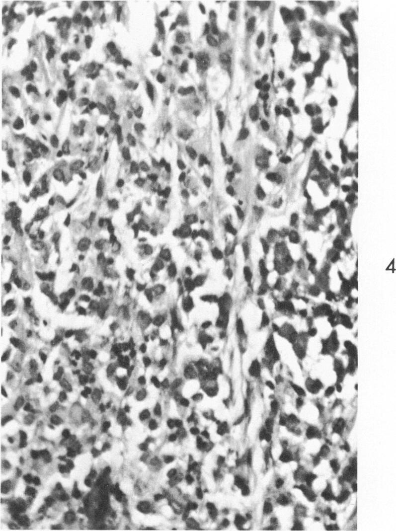 https://cdn.ncbi.nlm.nih.gov/pmc/blobs/97b4/1904034/0bc392ffe338/amjpathol00253-0163-d.jpg