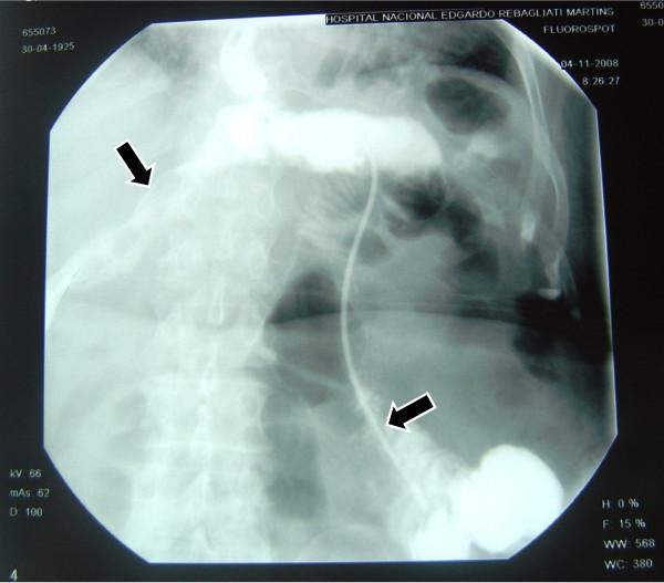 https://cdn.ncbi.nlm.nih.gov/pmc/blobs/97b9/2931501/5db0985f6d6d/1477-7819-8-71-4.jpg
