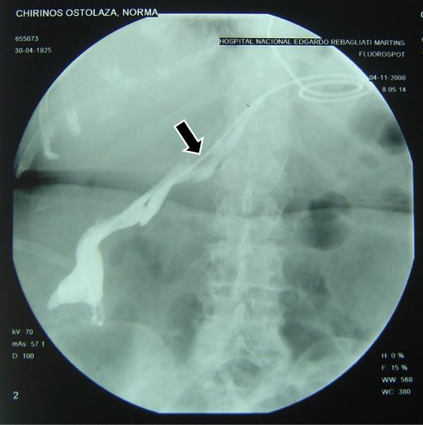 https://cdn.ncbi.nlm.nih.gov/pmc/blobs/97b9/2931501/78b94493f63e/1477-7819-8-71-3.jpg