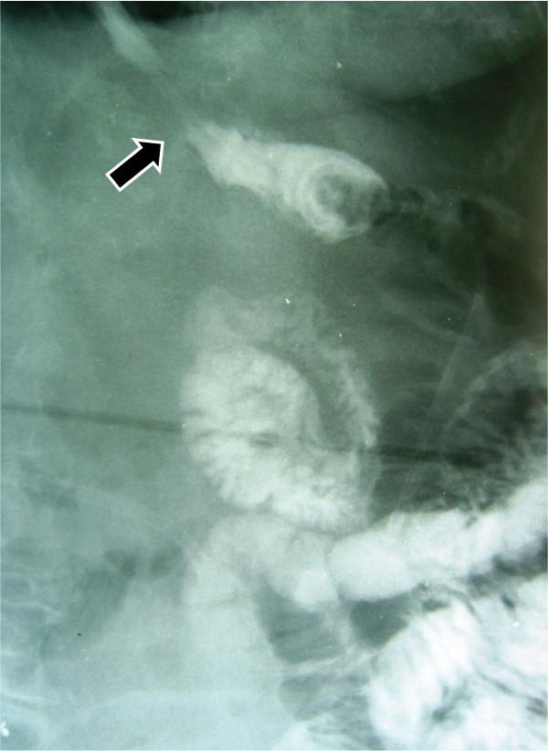 https://cdn.ncbi.nlm.nih.gov/pmc/blobs/97b9/2931501/e5917046caa6/1477-7819-8-71-5.jpg