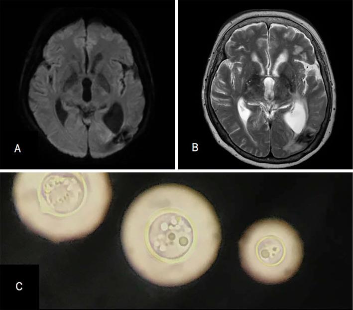 https://cdn.ncbi.nlm.nih.gov/pmc/blobs/97b9/6465021/ddbc795b9c06/1349-7235-58-0843-g001.jpg