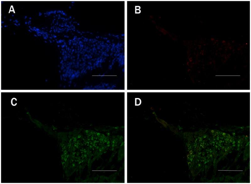 https://cdn.ncbi.nlm.nih.gov/pmc/blobs/97c1/4306511/f23ec4ffd0d6/pone.0117345.g006.jpg