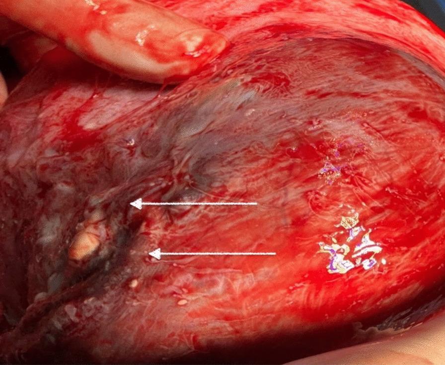 https://cdn.ncbi.nlm.nih.gov/pmc/blobs/97c5/11227696/a13eec085232/13256_2024_4640_Fig5_HTML.jpg